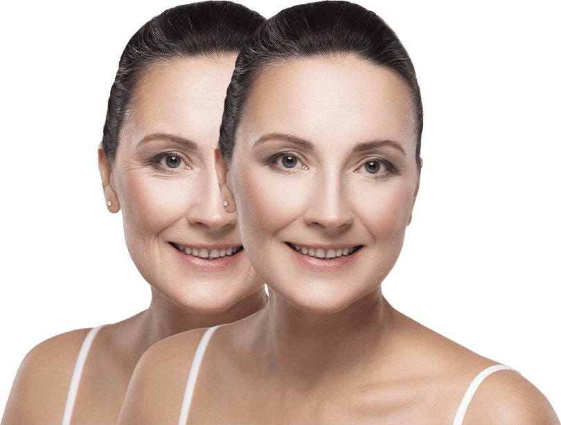 before-after-beauty-skin-wrinkles-treatment-procedure